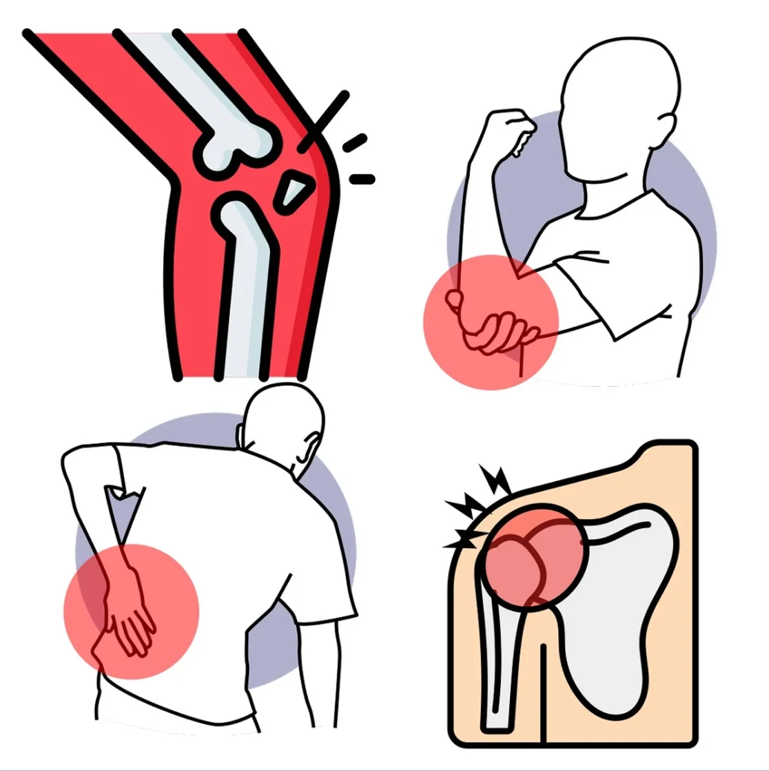 Ilustración de dolor en articulaciones
